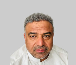 After hair transplant