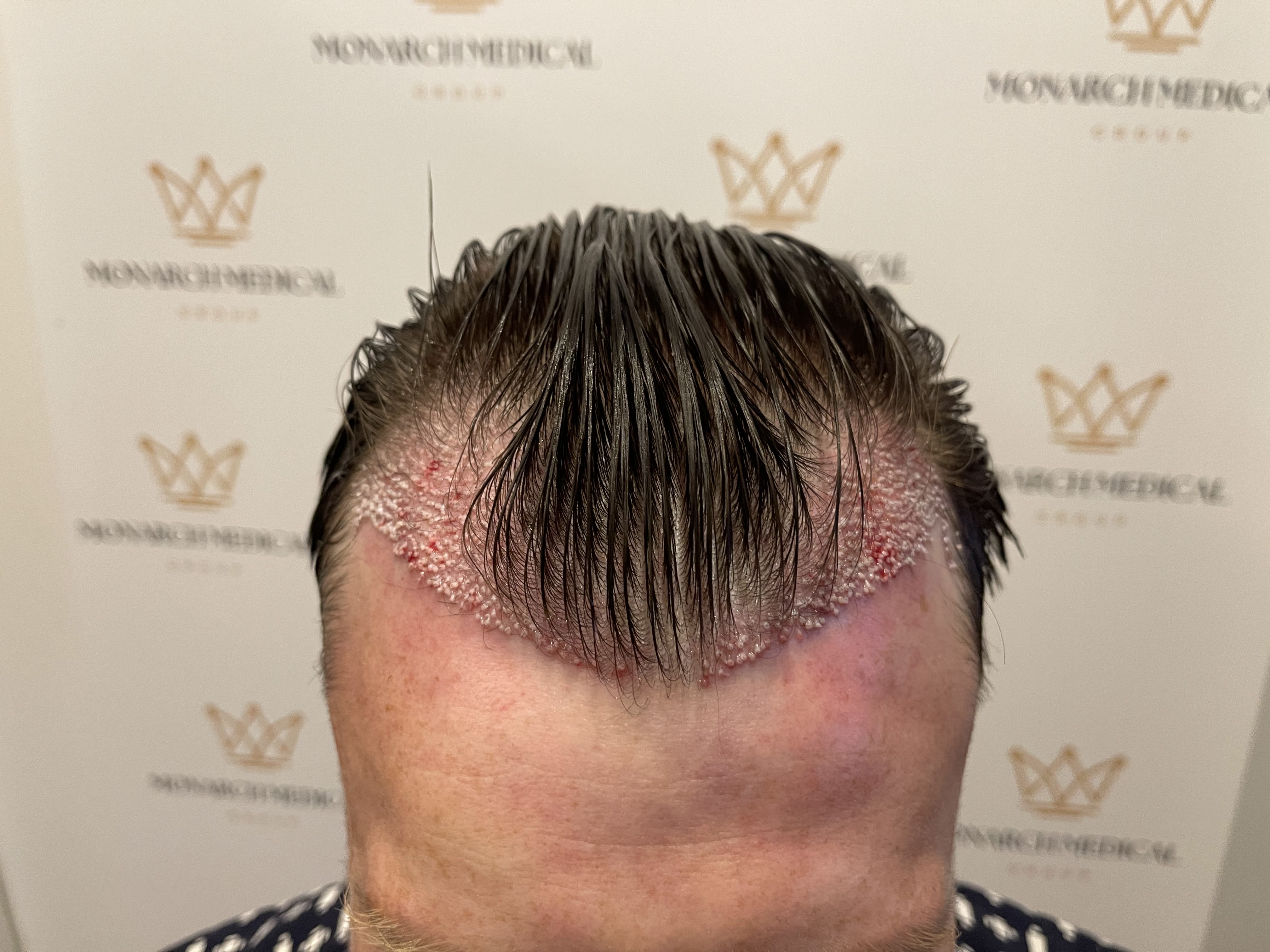 Ashley Reed hair restoration photo 3